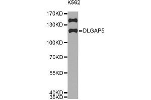 Western blot analysis of extracts of K562 cells, using DLGAP5 antibody (ABIN5971223) at 1/1000 dilution. (DLGAP5 抗体)