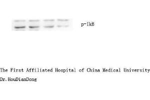 Western Blot (WB) analysis: Please contact us for more details. (NFKBIA 抗体  (pSer32, pSer36))