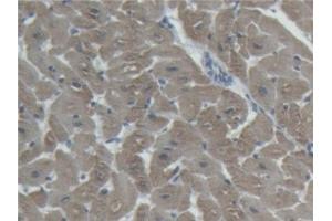 Detection of cTnI in Porcine Heart Tissue using Polyclonal Antibody to Cardiac Troponin I (cTnI) (TNNI3 抗体  (AA 2-211))