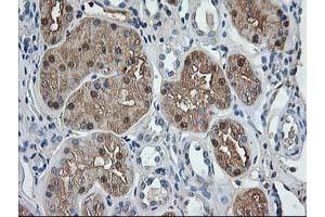 Immunohistochemical staining of paraffin-embedded Human Kidney tissue using anti-ACY1 mouse monoclonal antibody. (Aminoacylase 1 抗体)