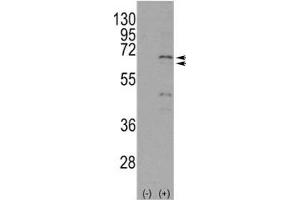 Western Blotting (WB) image for anti-Nuclear Receptor Subfamily 4, Group A, Member 1 (NR4A1) (AA 329-358) antibody (ABIN3032063)