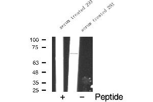 Western blot analysis of FKHR expression in serum treated 293 whole cell lysates,The lane on the left is treated with the antigen-specific peptide. (FOXO1 抗体  (Internal Region))