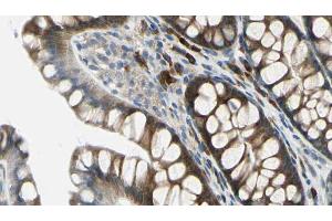 ABIN6272259 at 1/100 staining Rat colon tissue by IHC-P. (BTBD6 抗体  (Internal Region))