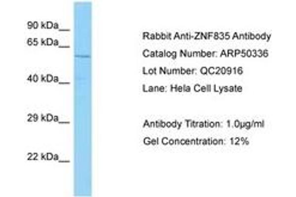 ZNF835 Antikörper  (AA 320-369)