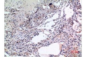 Immunohistochemistry (IHC) analysis of paraffin-embedded Human Lung, antibody was diluted at 1:100. (MCM7 抗体  (Internal Region))