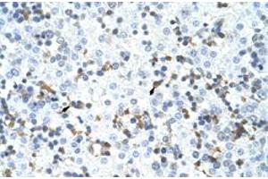 Immunohistochemical staining (Formalin-fixed paraffin-embedded sections) of human liver with CPSF3 polyclonal antibody  at 4-8 ug/mL working concentration. (CPSF3 抗体  (C-Term))