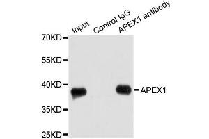 Immunoprecipitation analysis of 200ug extracts of HeLa cells using 1ug APEX1 antibody. (APEX1 抗体)