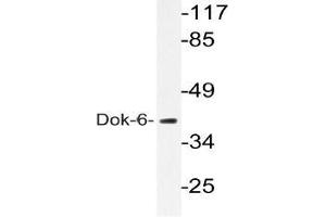 Western blot (WB) analysis of Dok-6 pAb in extracts from COLO205 cells. (DOK6 抗体)