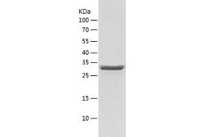Western Blotting (WB) image for Cyclin-Dependent Kinase 4 (CDK4) (AA 1-303) protein (His tag) (ABIN7122533) (CDK4 Protein (AA 1-303) (His tag))