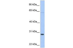 WB Suggested Anti-HPRT1 Antibody Titration:  0. (HPRT1 抗体  (Middle Region))