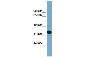 METAP1 antibody used at 1 ug/ml to detect target protein. (METAP1 抗体  (N-Term))