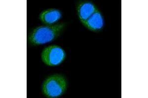 IF analysis of CD14 using anti-CD14 antibody (ABIN7600531). (CD14 抗体  (AA 20-259))