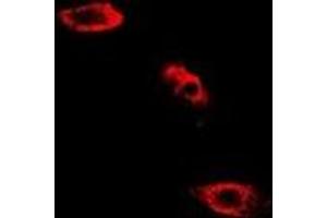 Immunofluorescent analysis of SHMT2 staining in HepG2 cells. (SHMT2 抗体)