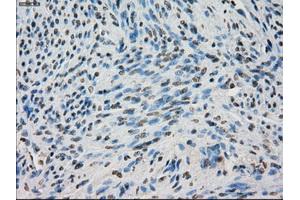 Immunohistochemical staining of paraffin-embedded Ovary tissue using anti-BUB1Bmouse monoclonal antibody. (BUB1B 抗体)