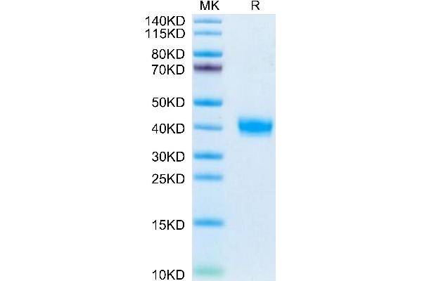 Prolactin Receptor Protein (PRLR) (AA 20-229) (His tag)
