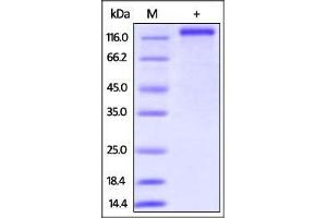SDS-PAGE (SDS) image for CD163 (CD163) (AA 42-1045) protein (His tag) (ABIN2870623)