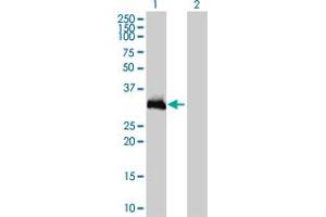 Western Blot analysis of HOXC9 expression in transfected 293T cell line by HOXC9 monoclonal antibody (M01), clone 2B12. (HOXC9 抗体  (AA 1-260))