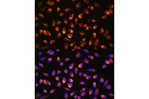 Immunofluorescence analysis of L929 cells using NQO1 Rabbit pAb (ABIN3022059, ABIN3022060, ABIN3022061 and ABIN6218589) at dilution of 1:100. (NQO1 抗体  (AA 1-50))