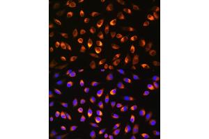Immunofluorescence analysis of L929 cells using NQO1 Rabbit pAb (ABIN3022059, ABIN3022060, ABIN3022061 and ABIN6218589) at dilution of 1:100. (NQO1 抗体  (AA 1-50))