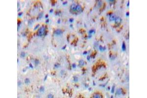 Used in DAB staining on fromalin fixed paraffin-embedded Liver tissue (MAPKSP1 抗体  (AA 1-124))