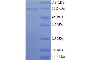 SDHD Protein (AA 1-440, full length) (His-SUMO Tag)