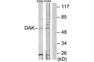 Western Blotting (WB) image for anti-TKFC / DAK (AA 91-140) antibody (ABIN2889629) (TKFC / DAK (AA 91-140) 抗体)