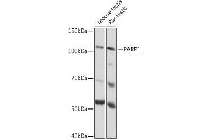 Western blot analysis of extracts of various cell lines, using P antibody  at 1:1000 dilution. (PARP1 抗体)