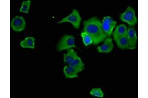 Immunofluorescence staining of MCF-7 cells with ABIN7168912 at 1:133, counter-stained with DAPI. (Hepsin 抗体  (AA 294-413))