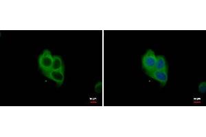 ICC/IF Image NOX1 antibody detects NOX1 protein at cytoplasm by immunofluorescent analysis. (NOX1 抗体)