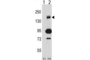Western Blotting (WB) image for anti-Mitogen-Activated Protein Kinase Kinase Kinase 5 (MAP3K5) antibody (ABIN2997990) (ASK1 抗体)
