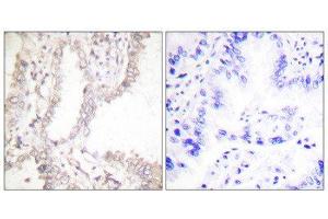 Immunohistochemistry (IHC) image for anti-PRKC, Apoptosis, WT1, Regulator (PAWR) (C-Term) antibody (ABIN1848751) (PAWR 抗体  (C-Term))