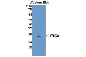 Western blot analysis of the recombinant protein. (TNP2 抗体  (AA 1-117))