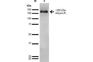 Western Blot analysis of Rat Brain showing detection of ~200 kDa Ankyrin-R protein using Mouse Anti-Ankyrin-R Monoclonal Antibody, Clone S388A-10 . (Erythrocyte Ankyrin 抗体  (AA 1-1881) (Atto 488))