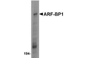 Western blot analysis of ARF-BP1 in Daudi cell lysate with ARF-BP1 antibody at 1 μg/ml.