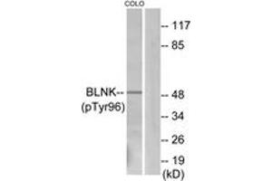 Western blot analysis of extracts from COLO205 cells, using BLNK (Phospho-Tyr96) Antibody.