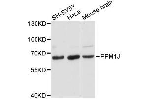 Western blot analysis of extracts of various cell lines, using PPM1J antibody. (PPM1J 抗体)