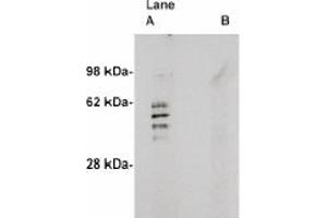 Image no. 1 for anti-Sphingomyelin Synthase 2 (SGMS2) antibody (ABIN4620351) (Sphingomyelin Synthase 2 抗体)