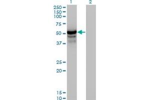 Western Blotting (WB) image for anti-Homocysteine-Inducible, Endoplasmic Reticulum Stress-Inducible, Ubiquitin-Like Domain Member 1 (HERPUD1) (AA 74-181) antibody (ABIN466153)