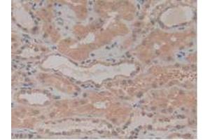 IHC-P analysis of Human Kidney Tissue, with DAB staining. (NUP210 抗体  (AA 1288-1449))