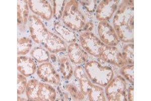 DAB staining on IHC-P; Samples: Human Kidney Tissue (IL12A 抗体  (AA 23-219))