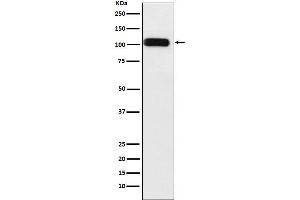 Western blot analysis of SERCA1 ATPase expression in Human fetal muscle lysate.