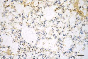 Immunohistochemistry was performed on paraffin-embedded mouse lung using pannexin 1 antibody (ABIN7799733), 1:200). (Recombinant PANX1 抗体)