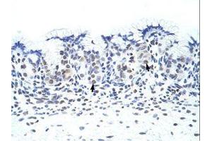 Image no. 1 for anti-Zinc Finger Protein 70 (ZNF70) (C-Term) antibody (ABIN202544) (ZNF70 抗体  (C-Term))