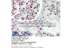 Immunohistochemistry (IHC) image for anti-T-Box 20 (TBX20) (N-Term) antibody (ABIN2777791) (TBX20 抗体  (N-Term))