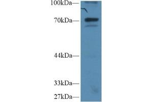 Detection of IkBz in Human Hela cell lysate using Polyclonal Antibody to Inhibitory Subunit Of NF Kappa B Zeta (IkBz) (Inhibitory Subunit of NF-KappaB zeta (AA 422-651) 抗体)