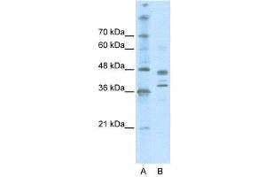 WB Suggested Anti-SMARCB1  Antibody Titration: 0. (SMARCB1 抗体  (Middle Region))