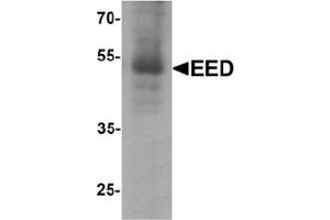 Western blot analysis of EED in human heart tissue lysate with EED Antibody  at 1 μg/ml. (EED 抗体  (N-Term))
