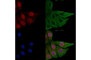 ABIN6258757 and ABIN6275019 staining Hela cells by IF/ICC.