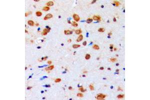 Immunohistochemical analysis of AKT (pY315) staining in human brain formalin fixed paraffin embedded tissue section. (AKT1 抗体  (pTyr315))
