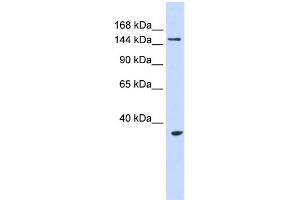 WB Suggested Anti-UBE3B Antibody Titration:  0. (UBE3B 抗体  (Middle Region))
